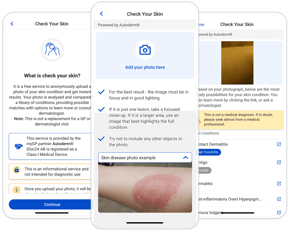 Check your skin with the AI powered skin scanner